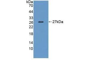 Detection of Recombinant LRP1B, Human using Polyclonal Antibody to Low Density Lipoprotein Receptor Related Protein 1B (LRP1B) (LRP1B 抗体  (AA 31-194))
