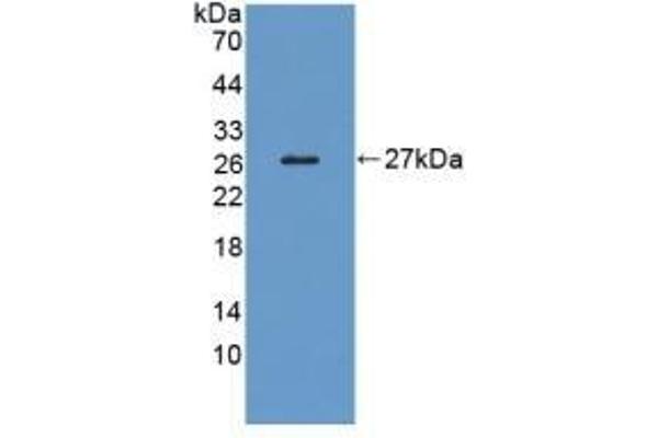 LRP1B Antikörper  (AA 31-194)