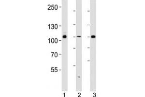 Western blot analysis of lysate from 293, HUVEC, T47D cell line (left to right) using GAB1 antibody diluted at 1:1000 for each lane. (GAB1 抗体  (AA 250-285))