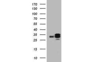 Image no. 6 for anti-Palmitoyl-Protein Thioesterase 1 (PPT1) (AA 100-306) antibody (ABIN1490802) (PPT1 抗体  (AA 100-306))