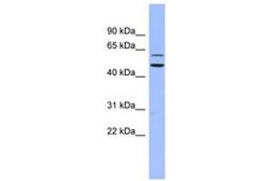 Image no. 1 for anti-Dyskeratosis Congenita 1, Dyskerin (DKC1) (AA 35-84) antibody (ABIN6742970) (DKC1 抗体  (AA 35-84))
