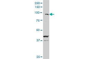 ZFHX1B monoclonal antibody (M02), clone 2H5. (ZEB2 抗体  (AA 1115-1214))