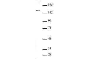 SIN3A antibody (pAb) tested by Western blot. (SIN3A 抗体  (N-Term))