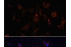 Immunofluorescence analysis of C6 cells using GLRX Polyclonal Antibody at dilution of 1:100. (Glutaredoxin 1 抗体)