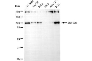 Western blotting analysis using ZNF598 antibody (ABIN7800899). (ZNF598 抗体)