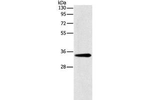 Western Blot analysis of Mouse liver tissue using GNMT Polyclonal Antibody at dilution of 1:200 (GNMT 抗体)