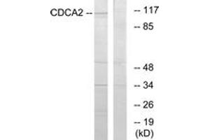 Western blot analysis of extracts from 293 cells, using CDCA2 Antibody. (CDCA2 抗体  (AA 511-560))
