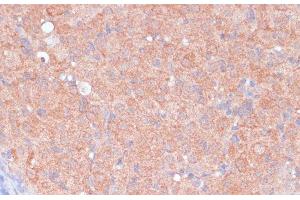 Immunohistochemistry of paraffin-embedded Rat ovary using LRP1 Polyclonal Antibody at dilution of 1:100 (40x lens). (LRP1 抗体)