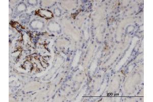 Immunoperoxidase of monoclonal antibody to UPP1 on formalin-fixed paraffin-embedded human kidney. (UPP1 抗体  (AA 1-92))