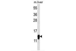 C1orf144 Antibody (N-term) western blot analysis in mouse liver tissue lysates (35µg/lane). (C1orf144 抗体  (N-Term))