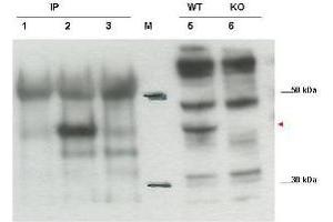 Image no. 1 for anti-Cytohesin 1 Interacting Protein (CYTIP) (C-Term) antibody (ABIN1101060) (CYTIP 抗体  (C-Term))