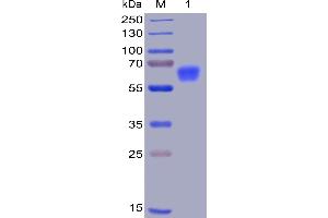 Human CD47, mFc-His Tag on SDS-PAGE under reducing condition.