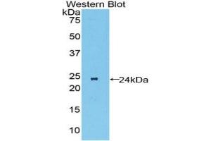 MST1R anticorps  (AA 89-275)