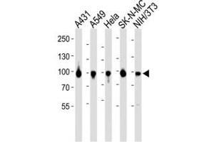 Western blot analysis of lysate from A431, A549, HeLa, SK-N-MC, mouse NIH3T3 cell line using HSP90 antibody diluted at 1:1000 for each lane.