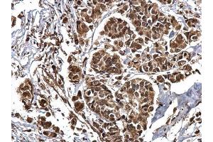 Immunohistochemistry (IHC) image for anti-CREB Binding Protein (CREBBP) (C-Term) antibody (ABIN2854987)