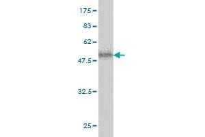 Western Blot detection against Immunogen (58. (ICK 抗体  (AA 1-292))