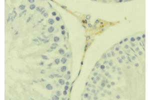 ABIN6279287 at 1/100 staining Mouse testis tissue by IHC-P. (CKLF 抗体  (C-Term))