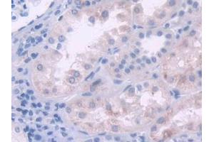 Immunohistochemistry (IHC) image for anti-Interleukin 2 (IL2) (AA 21-153) antibody (ABIN7430795)