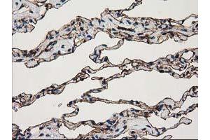 Image no. 3 for anti-Annexin A3 (ANXA3) antibody (ABIN1496642) (Annexin A3 抗体)