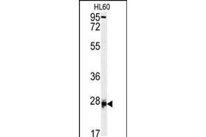 Western blot analysis of DPT antibody in HL60 cell line lysates (35ug/lane) (Dermatopontin 抗体  (AA 102-128))