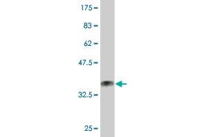 Western Blot detection against Immunogen (33. (CCRK 抗体  (AA 183-257))
