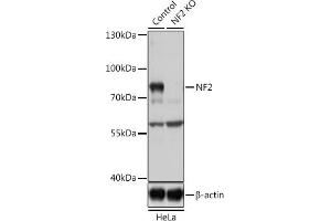 Western Blotting (WB) image for anti-Neurofibromin 2 (NF2) (AA 477-576) antibody (ABIN6144548)