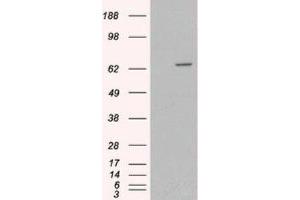 Western Blotting (WB) image for anti-Myotubularin 1 (MTM1) (C-Term) antibody (ABIN2465965) (MTM1 抗体  (C-Term))