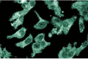 Immunofluoresent staining of ES2 cells with anti-CD105/endoglin antibody. (Endoglin 抗体  (AA 24-144))