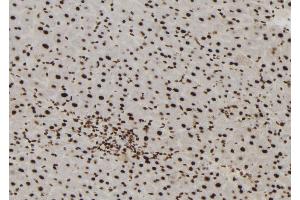 ABIN6272965 at 1/100 staining Mouse liver tissue by IHC-P. (MTA3 抗体  (Internal Region))
