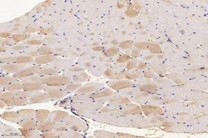 Immunohistochemistry analysis of paraffin-embedded mouse muscle using,SLC8A3 (ABIN7075684) at dilution of 1: 1600 (SLC8A3 抗体)