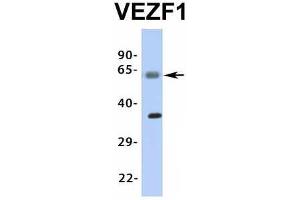 Western Blotting (WB) image for anti-Vascular Endothelial Zinc Finger 1 (VEZF1) (Middle Region) antibody (ABIN2776482)