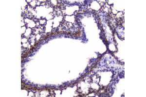 Immunohistochemistry (IHC) image for anti-Myosin Light Chain Kinase (MYLK) (AA 1441-1709) antibody (ABIN5693029)