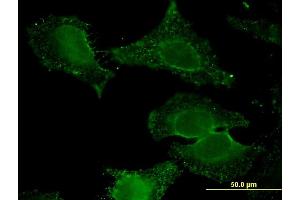 Immunofluorescence of monoclonal antibody to ALDH9A1 on HeLa cell. (ALDH9A1 抗体  (AA 173-270))