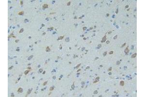 IHC-P analysis of Human Brain Tissue, with DAB staining. (SMAD9 抗体  (AA 226-459))