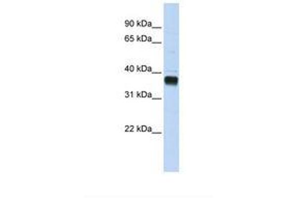 NUDT18 抗体  (AA 252-301)