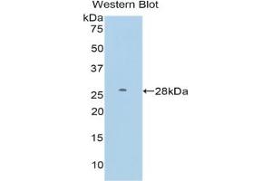 Western blot analysis of the recombinant protein. (FDFT1 抗体  (AA 187-416))