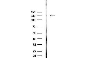Western blot analysis of lysates from Mouse liver, using USP42 Antibody at 1/1000 dilution.