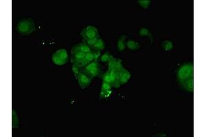 Immunofluorescent analysis of MCF-7 cells using ABIN7161840 at dilution of 1:100 and Alexa Fluor 488-congugated AffiniPure Goat Anti-Rabbit IgG(H+L) (NUP214 抗体  (AA 28-238))