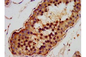 IHC image of ABIN7144009 diluted at 1:200 and staining in paraffin-embedded human testis tissue performed on a Leica BondTM system. (AMMECR1 抗体  (AA 146-248))