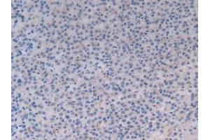 Detection of MFGE8 in Rat Adrenal Gland Tissue using Polyclonal Antibody to Milk Fat Globule EGF Factor 8 (MFGE8) (MFGE8 抗体  (AA 73-421))