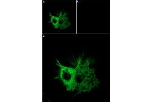 Unlabeled ω-Agatoxin successfully blocks CaV2. (omega-agatoxin IVA peptide (Atto 647N))