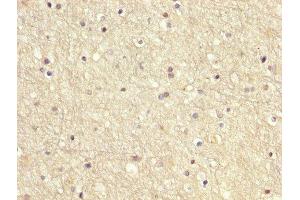 IHC image of ABIN7166949 diluted at 1:200 and staining in paraffin-embedded human brain tissue performed on a Leica BondTM system. (GDI1 抗体  (AA 35-170))