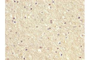 IHC image of ABIN7166949 diluted at 1:200 and staining in paraffin-embedded human brain tissue performed on a Leica BondTM system. (GDI1 抗体  (AA 35-170))