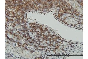 Immunoperoxidase of monoclonal antibody to STK16 on formalin-fixed paraffin-embedded human tonsil. (STK16 抗体  (AA 1-305))