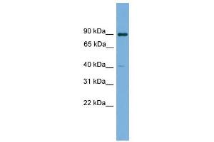 KCTD16 antibody used at 1 ug/ml to detect target protein. (KCTD16 抗体  (N-Term))