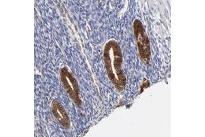 Immunohistochemical staining of human uterine corpus with DCTPP1 polyclonal antibody  shows strong cytoplasmic and nuclear positivity in glandular cells at 1:200-1:500 dilution. (DCTPP1 抗体)