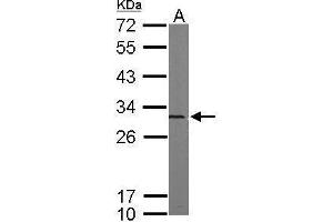 WB Image Sample (50 ug of whole cell lysate) A: mouse brain 12% SDS PAGE antibody diluted at 1:5000 (PSMA5 抗体  (Center))