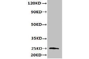 Western blot All lanes: TMED3 antibody at 6 μg/mL + MCF-7 whole cell lysate Secondary Goat polyclonal to rabbit IgG at 1/10000 dilution Predicted band size: 25, 20 kDa Observed band size: 25 kDa (TMED3 抗体  (AA 24-180))