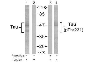 Image no. 2 for anti-Microtubule-Associated Protein tau (MAPT) (Thr231) antibody (ABIN197266) (MAPT 抗体  (Thr231))
