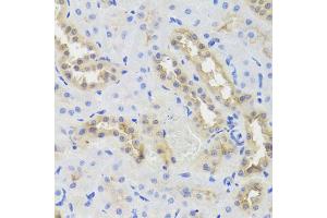 Immunohistochemistry of paraffin-embedded rat kidney using DISC1 antibody (ABIN5971500) at dilution of 1/100 (40x lens). (DISC1 抗体)